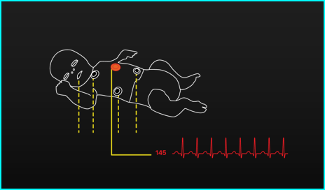 Image-processed display of infant filtering only "need-to-know" information