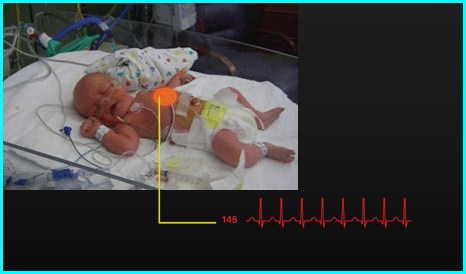 Live feed display of infant with sensor highlight